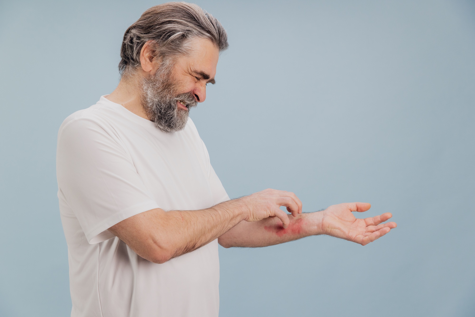 Senior man scratching itchy eczema on arm suffering from dermatitis